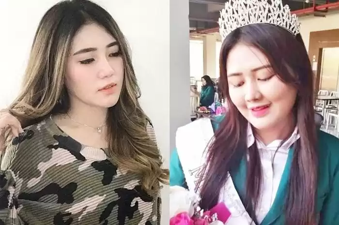 Adik Via Vallen Positif Covid19, Ini Cerita Kronologi Lengkapnya 