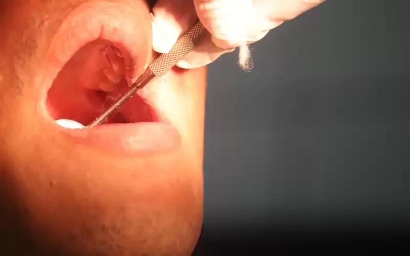 Cara Menjaga Kebersihan Mulut Saat Berpuasa Dengan Sikat Gigi