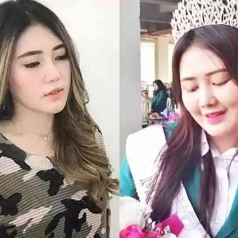 Adik Via Vallen Positif Covid19, Ini Cerita Kronologi Lengkapnya 