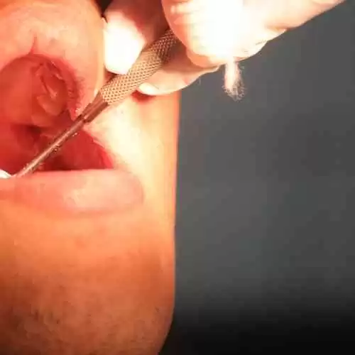 5 Olahraga Terbaik untuk Meningkatkan Kesehatan Jantung Anda