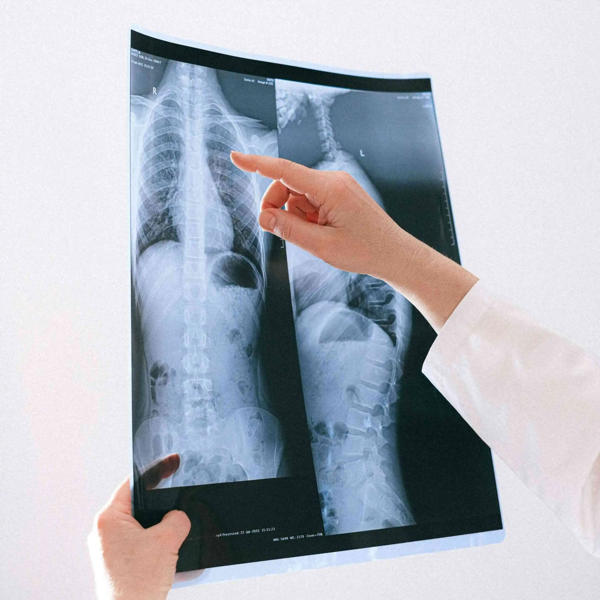 Memahami Perbedaan Gejala Paru-paru Kotor dengan Paru-paru Sehat